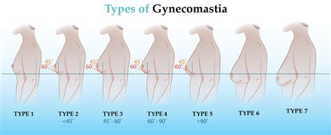 Normal Breast Development and Changes